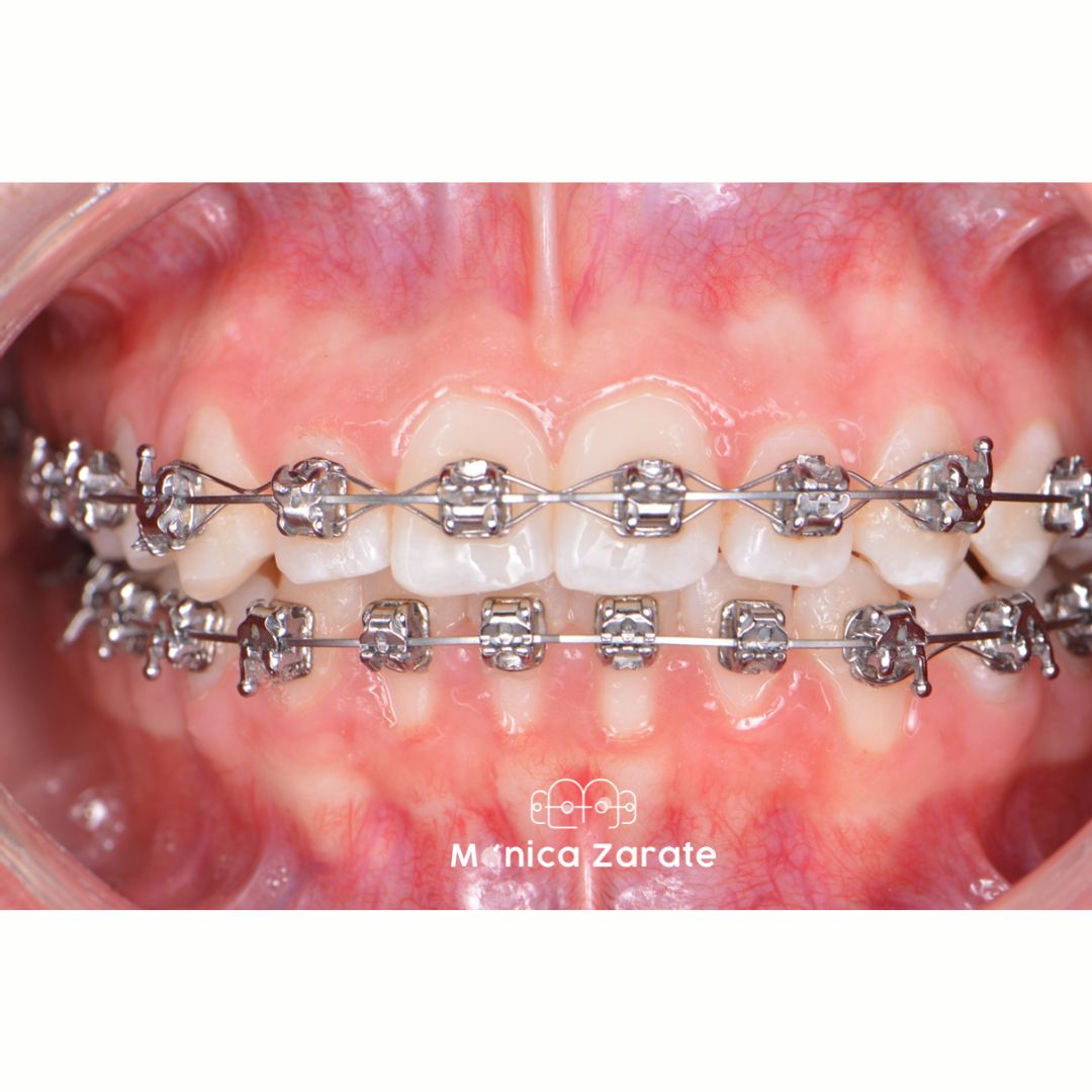 Mónica Isabel Zárate Pérez-19