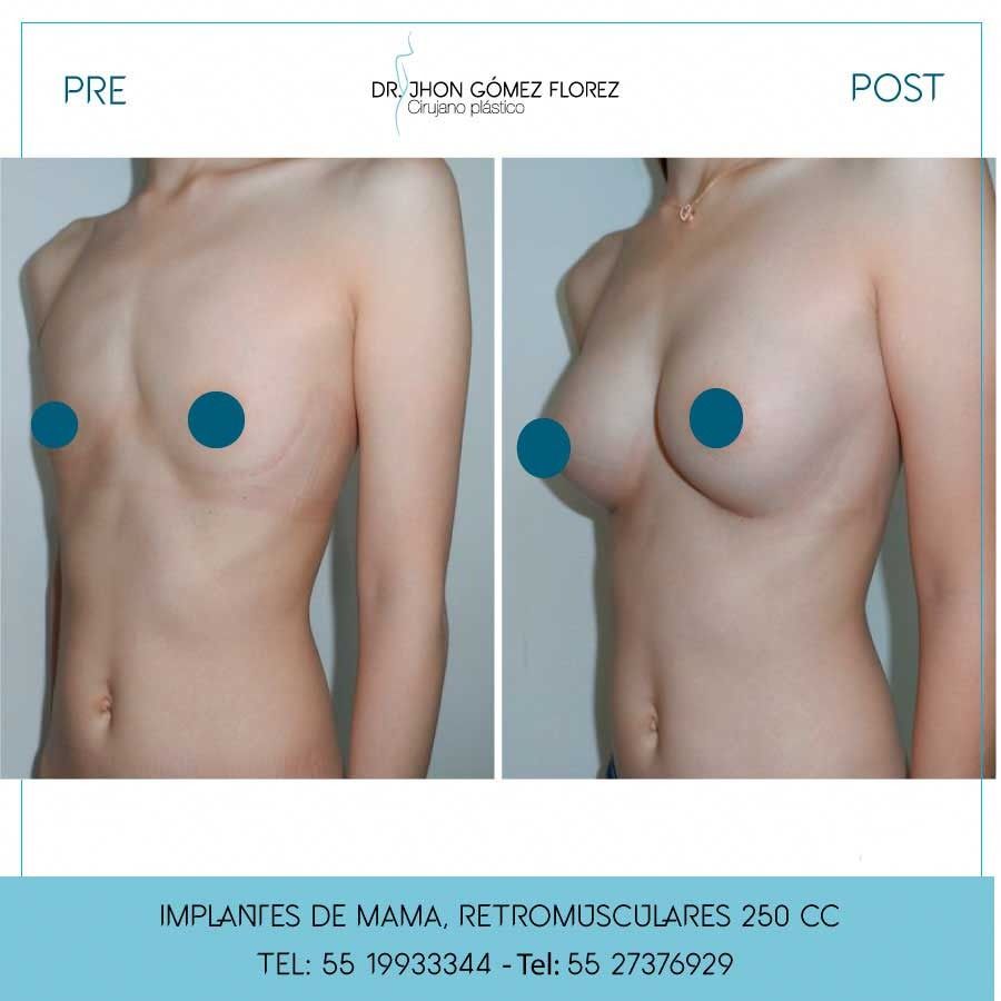 Jhon César Gómez Florez-16