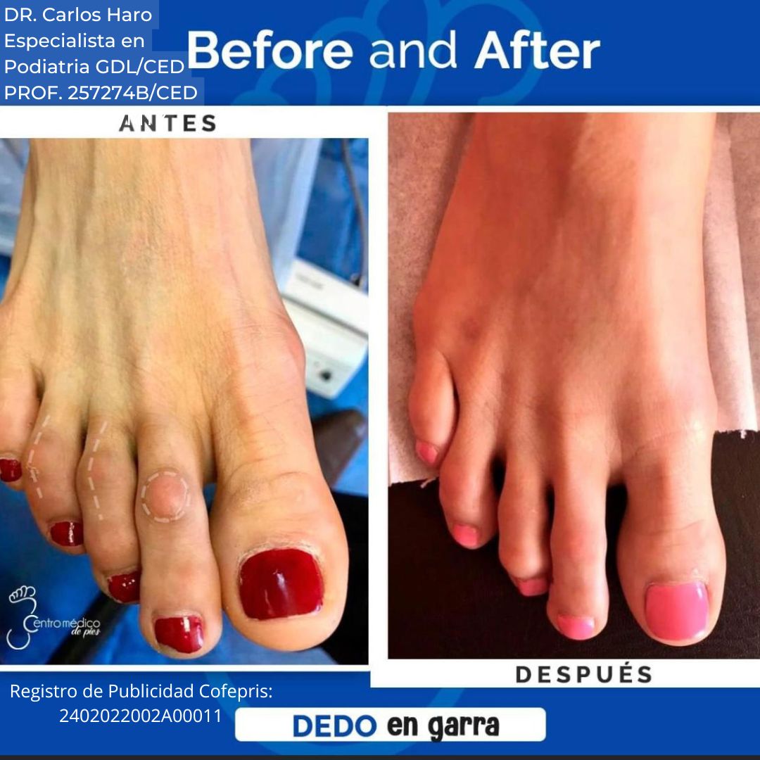 Carlos Alberto Haro Prieto-8