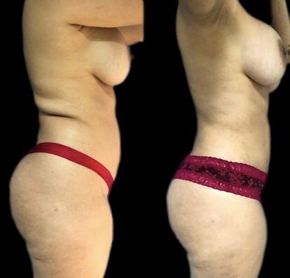 Luis Atilio Gil Pérez-14