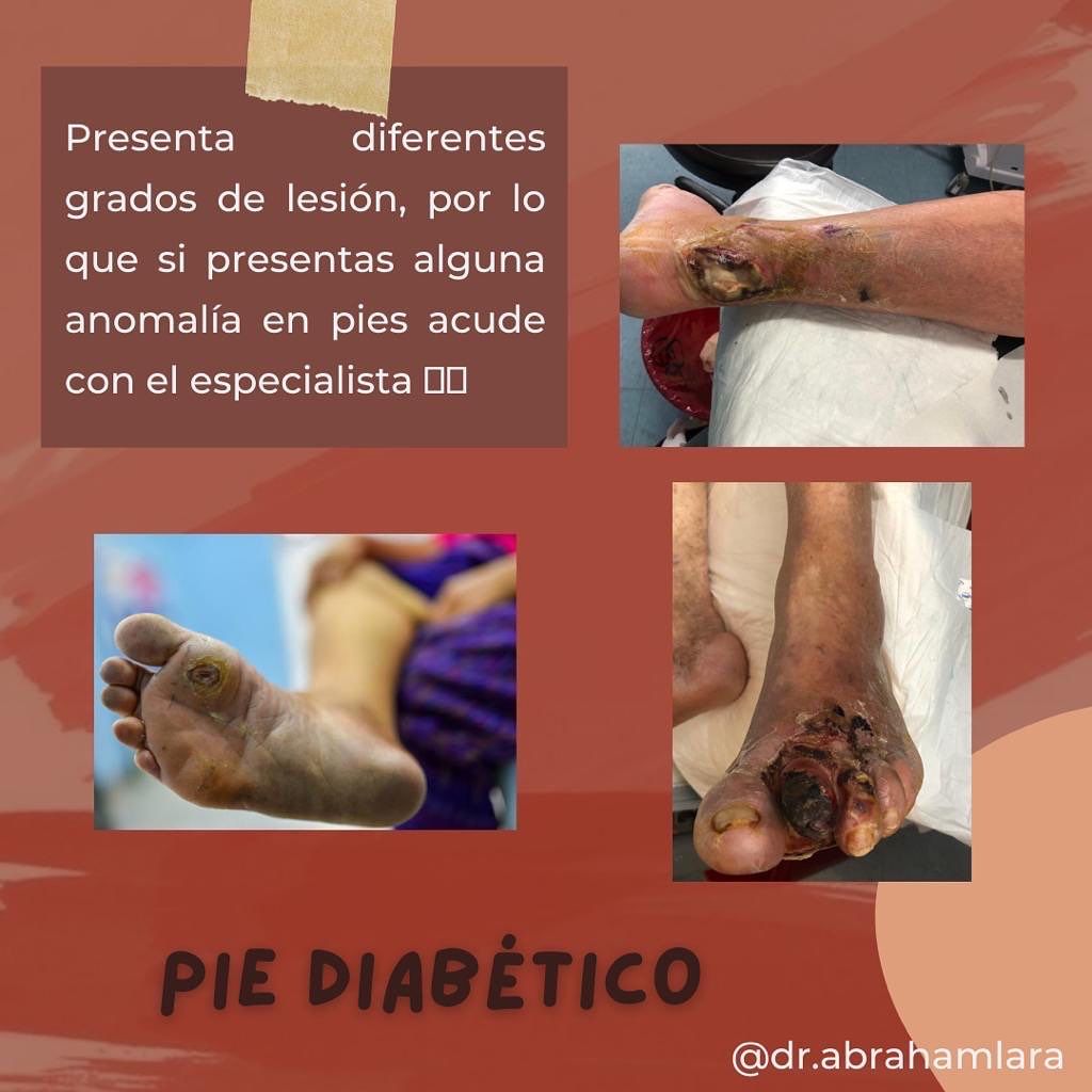 Miguel Abraham Lara Perez-27