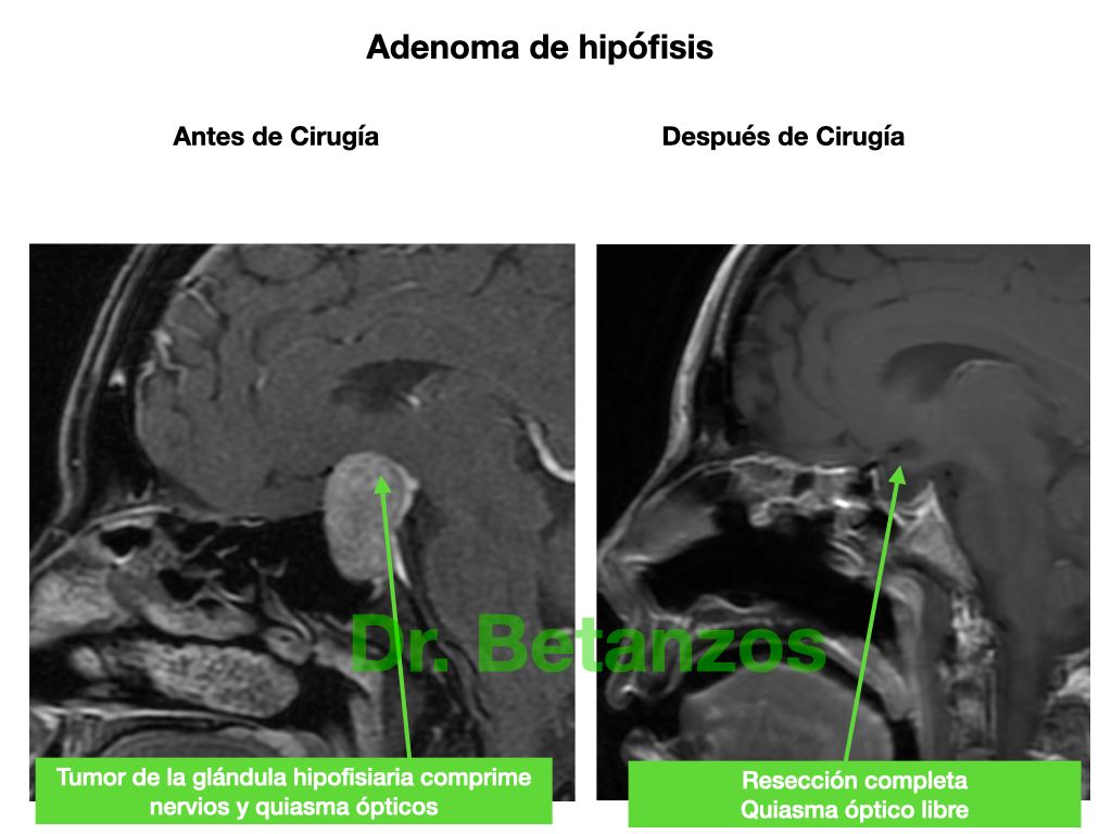 Aleixandre Betanzos Villegas-20