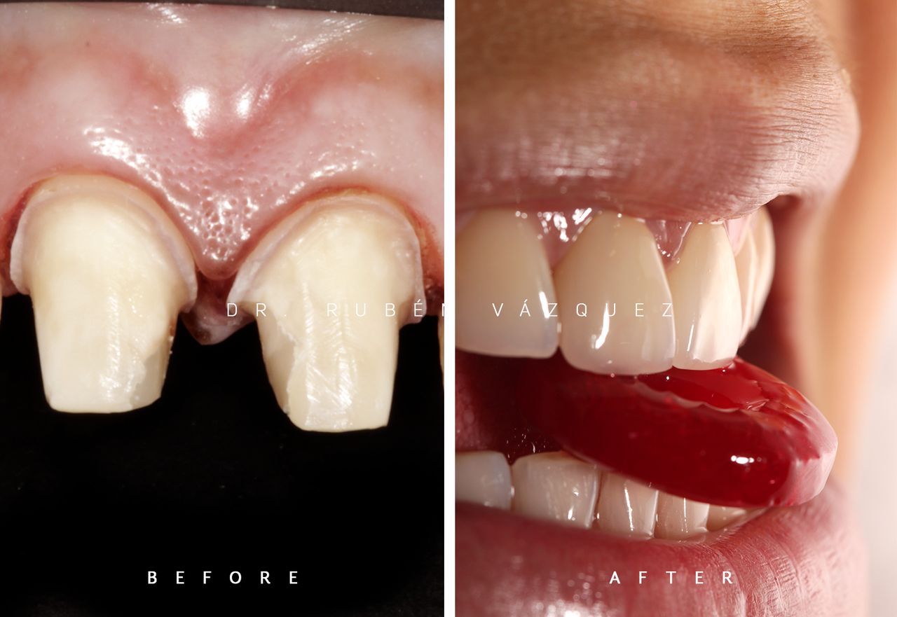 Rubén Vázquez Alanís-4