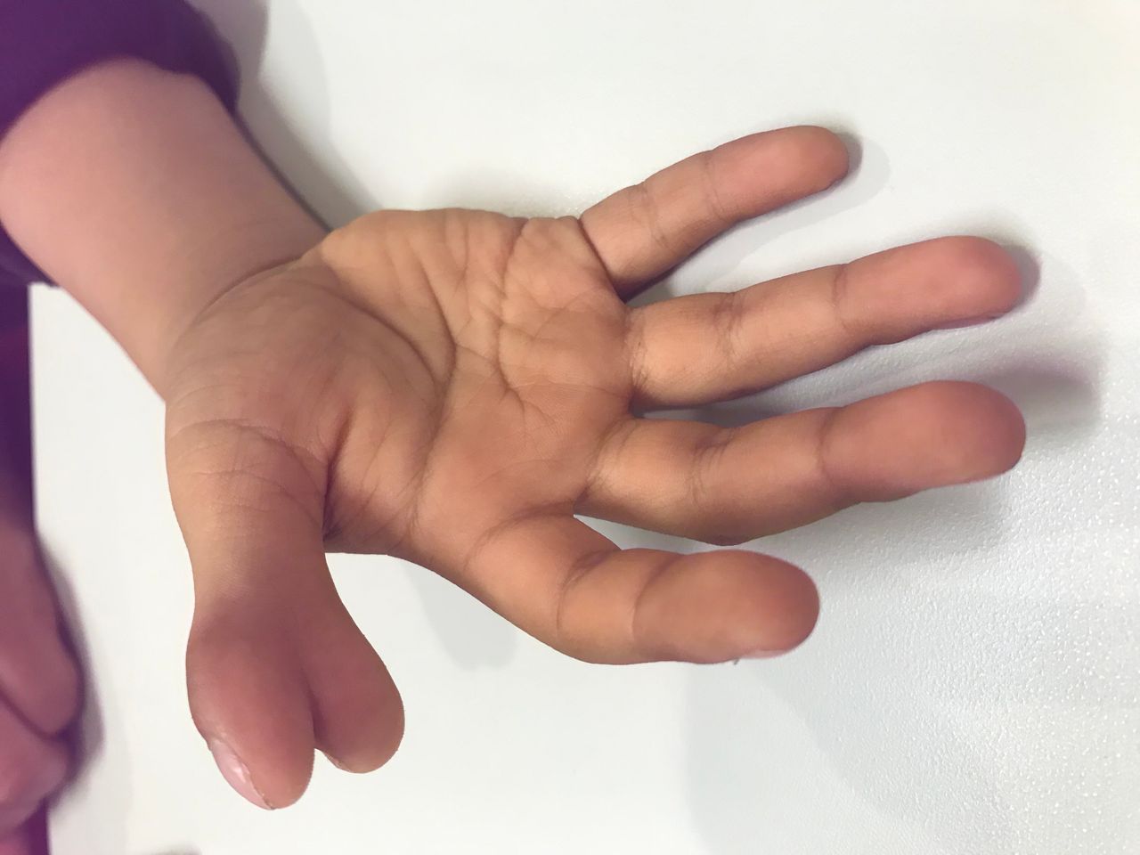 Ignacio Osvaldo Fortis Olmedo-24