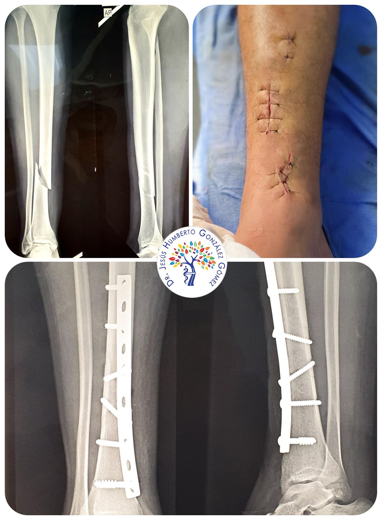 Jesús Humberto González Gómez-24