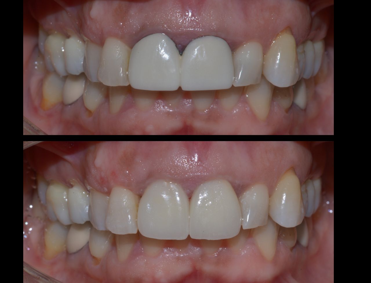 María Fernanda González Gastelum-36