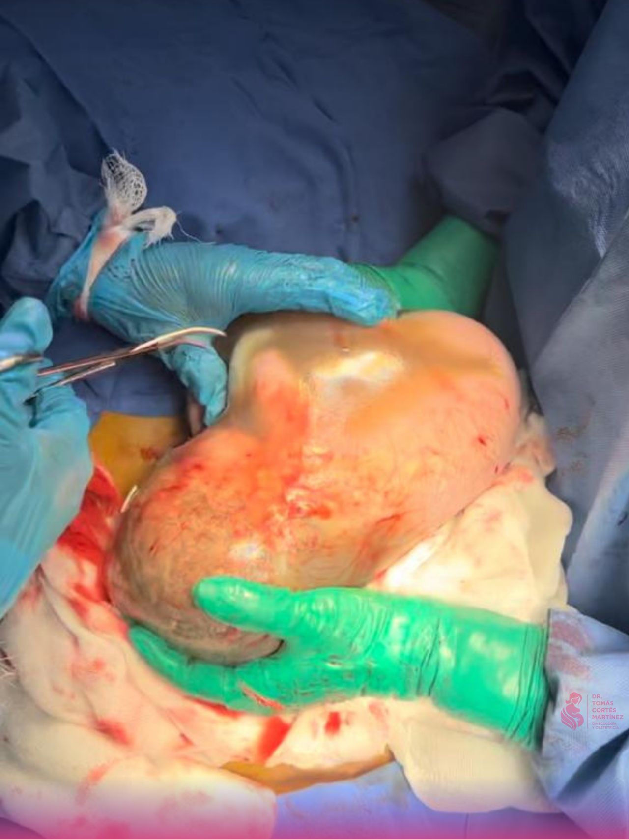 Tomás Cortés Martínez-6