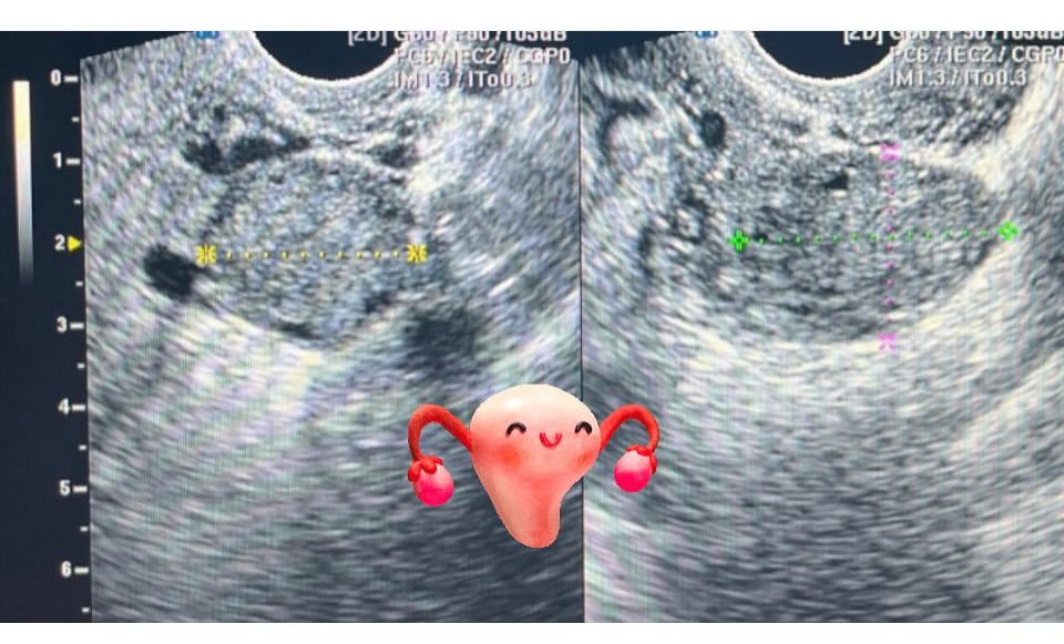 Ana Itzel Gaona Guevara-6