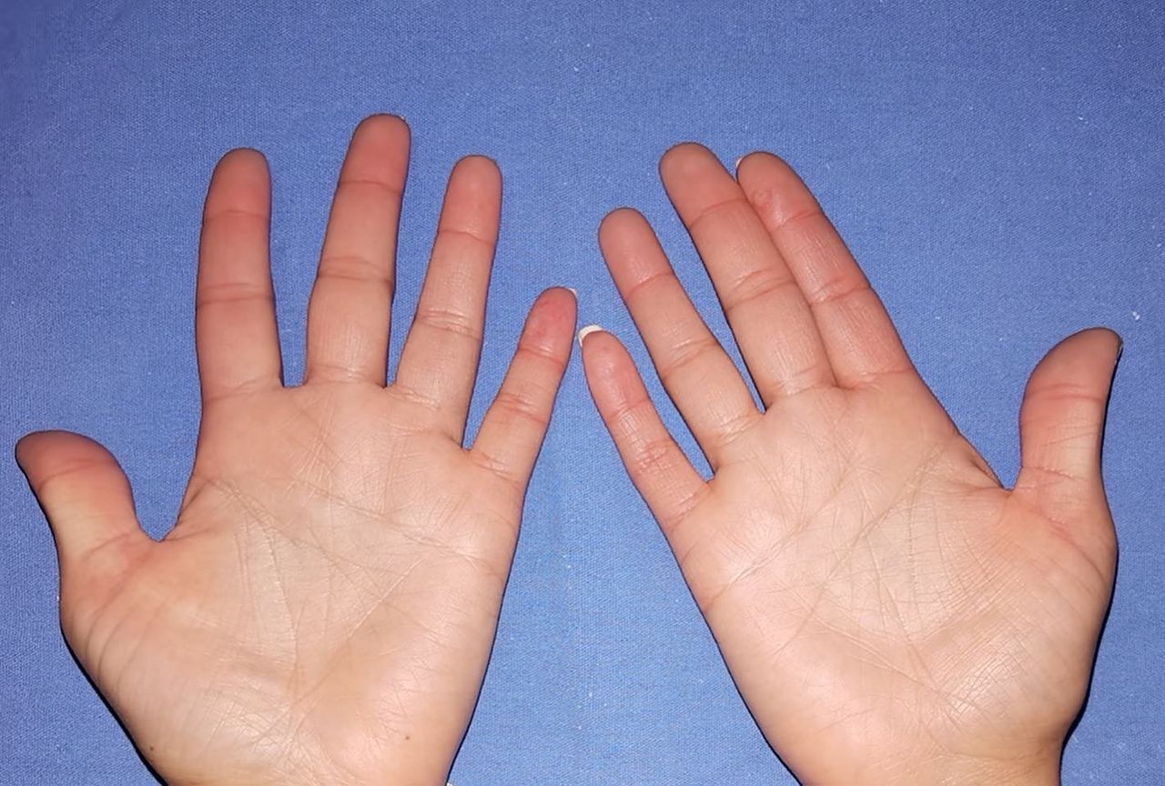 Lauro Francisco Varela Coronado-8