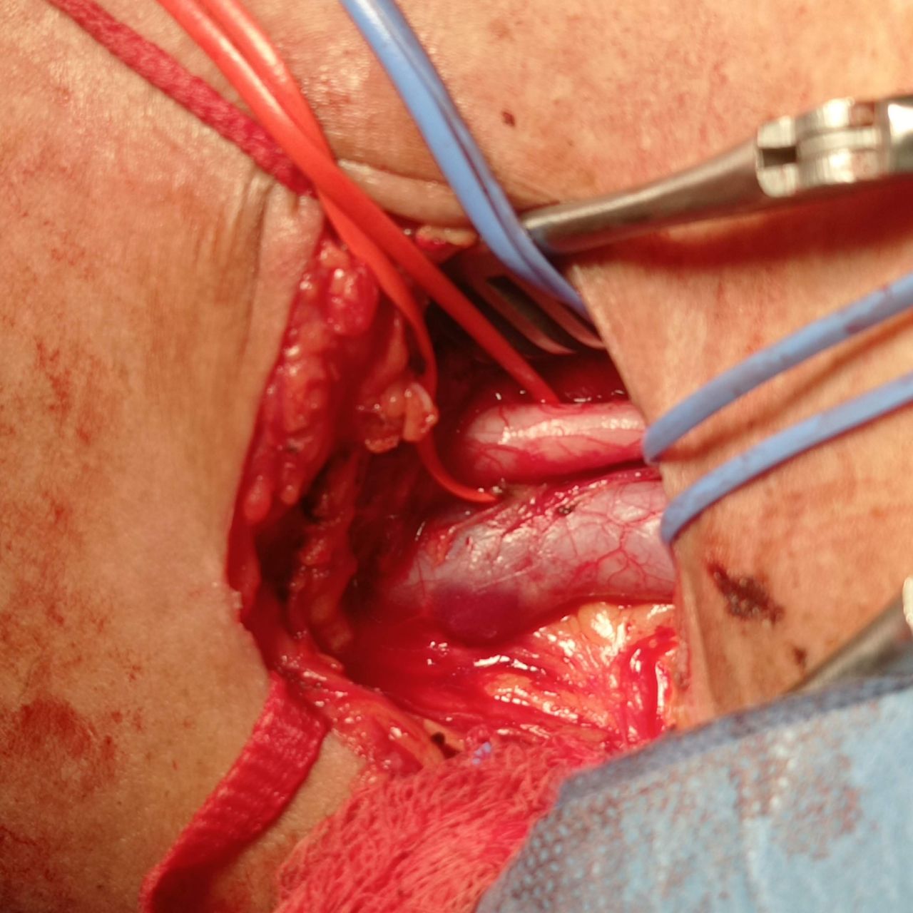 Diana Mojarro Velazco-7