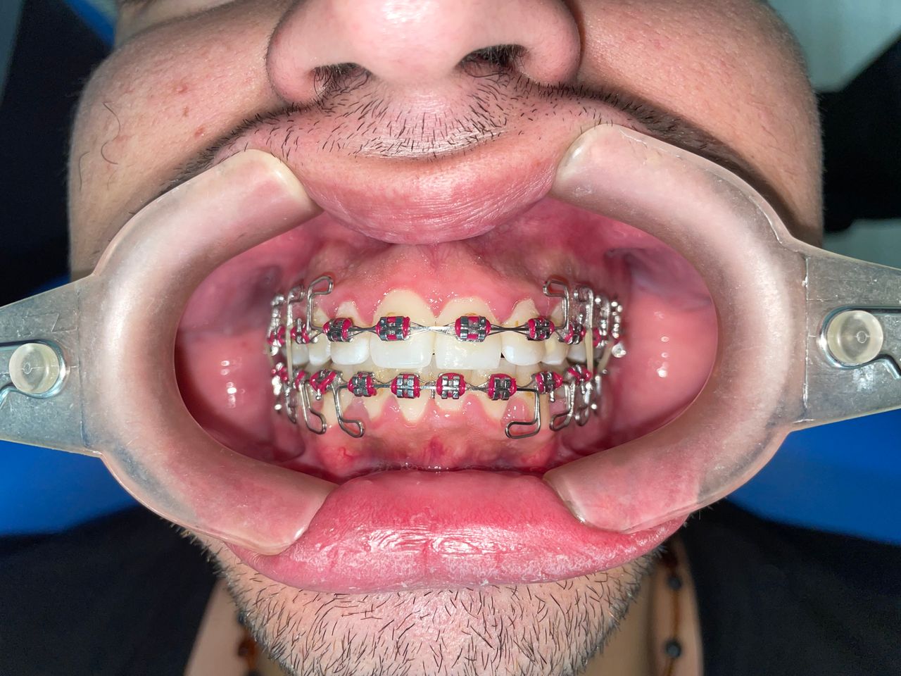 Luis Ernesto Calva Valdez-17