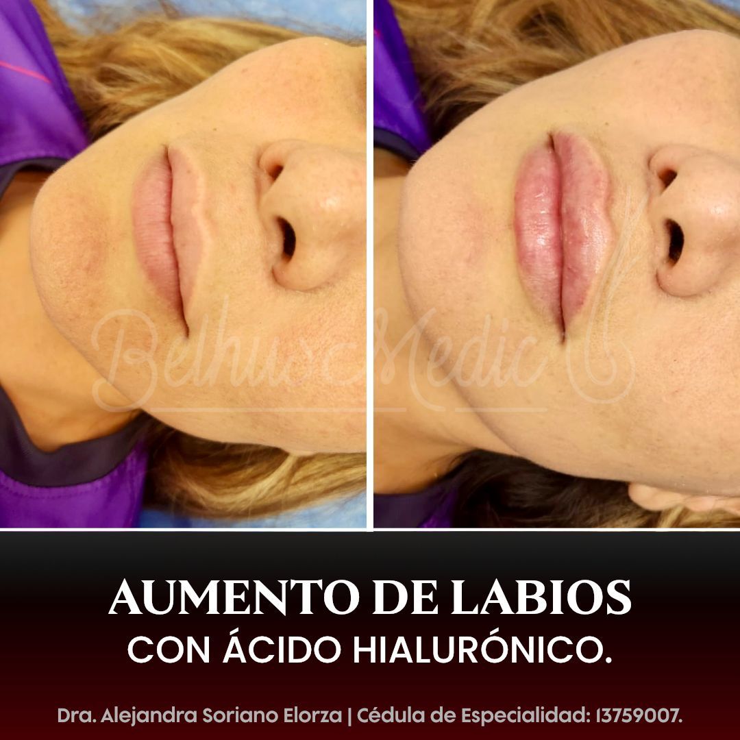 Alejandra Soriano Elorza-77