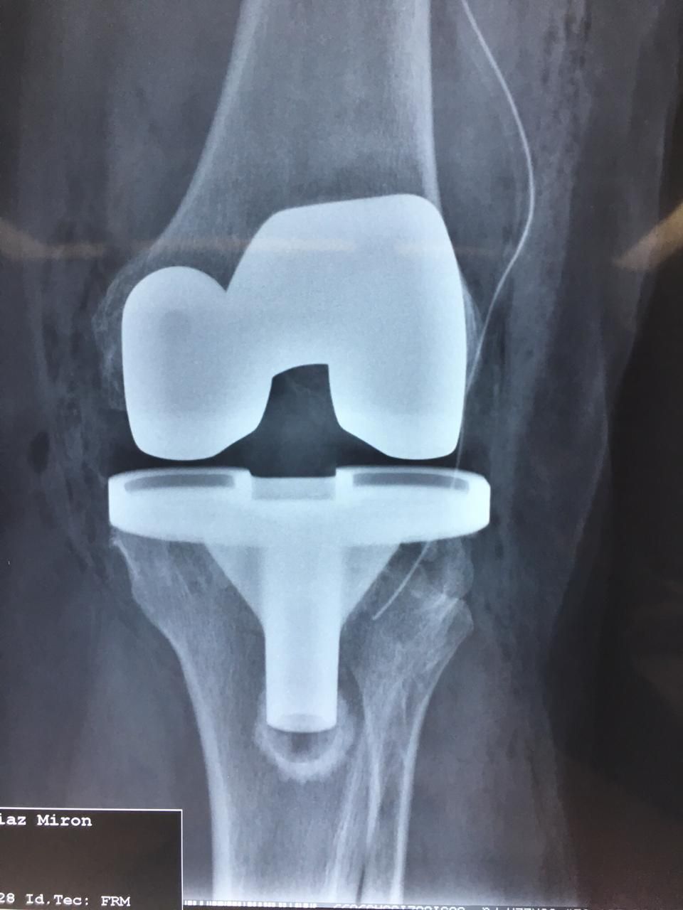 Neftali Lagos Mariscal-4