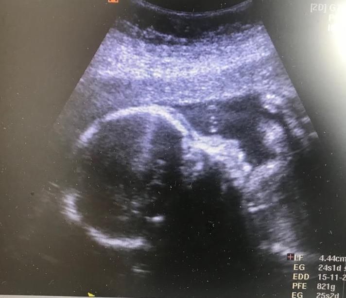 Germán Gabriel Palacios López-7