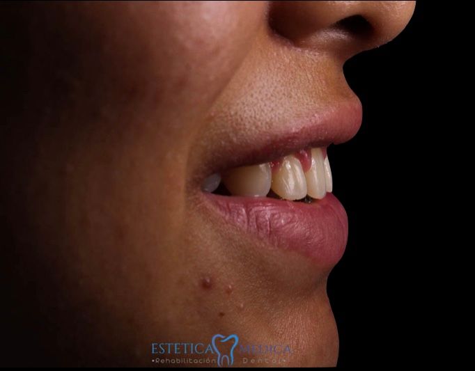 Bielmy Veronica Jonapa Peña-14