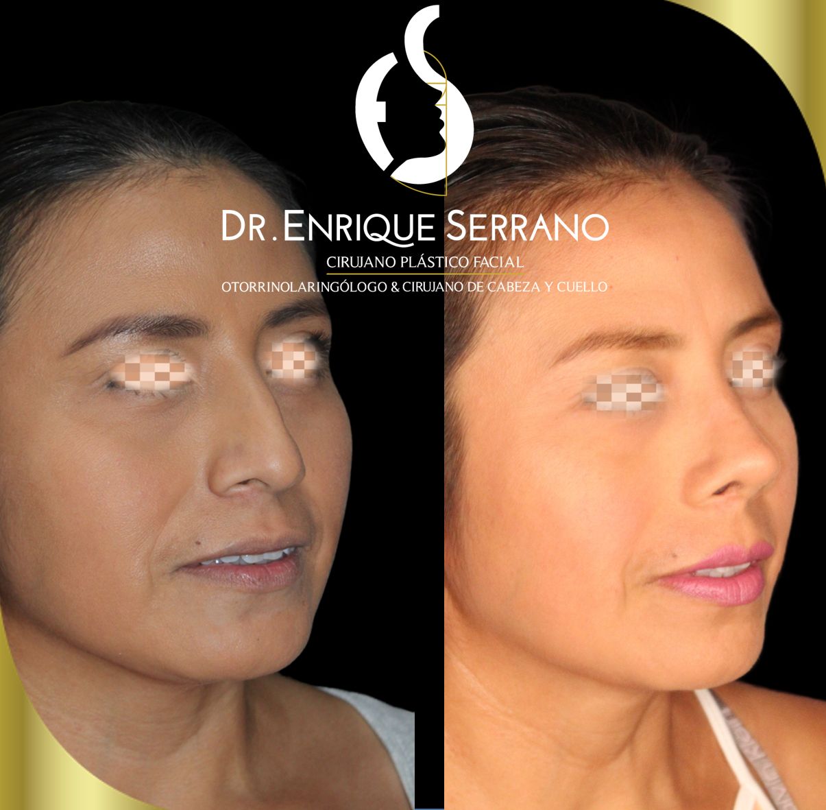 Enrique Serrano Cruz-6