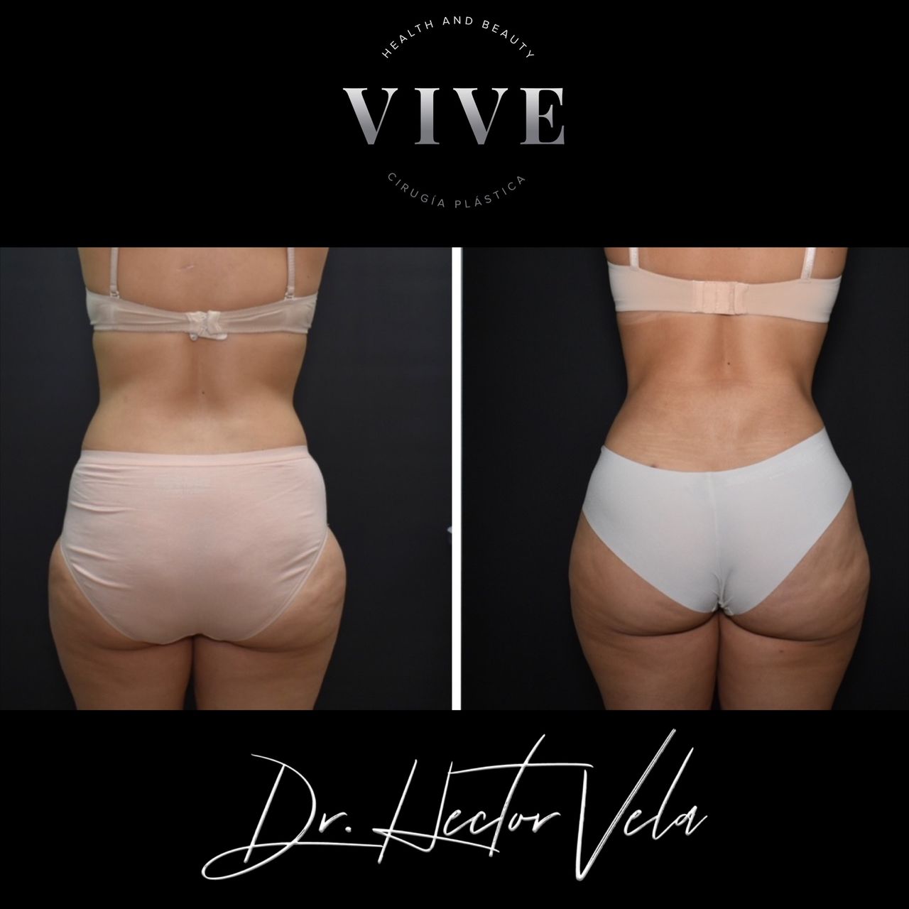 Héctor Eduardo Vela Cardona-92