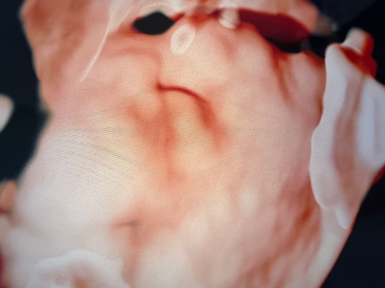 Benjamín Isai Molina Solís-5