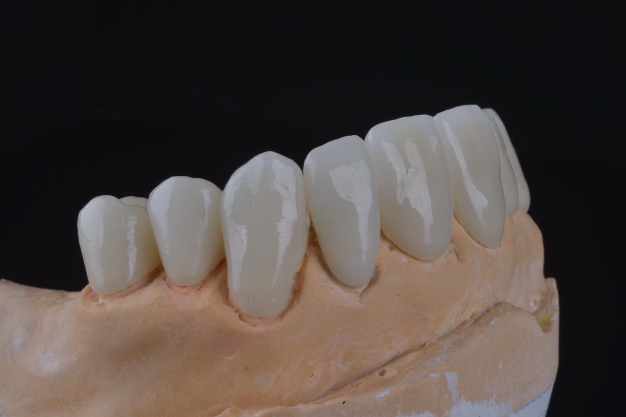 Aimee Valles Monárrez-42