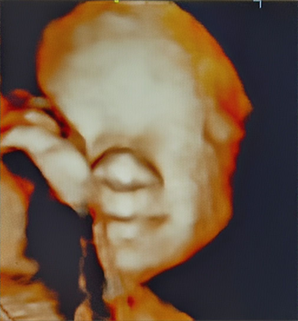 Ramón  Pascacio Pérez -0