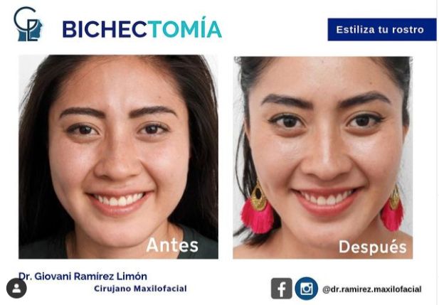 Giovani Ramírez Limón-21