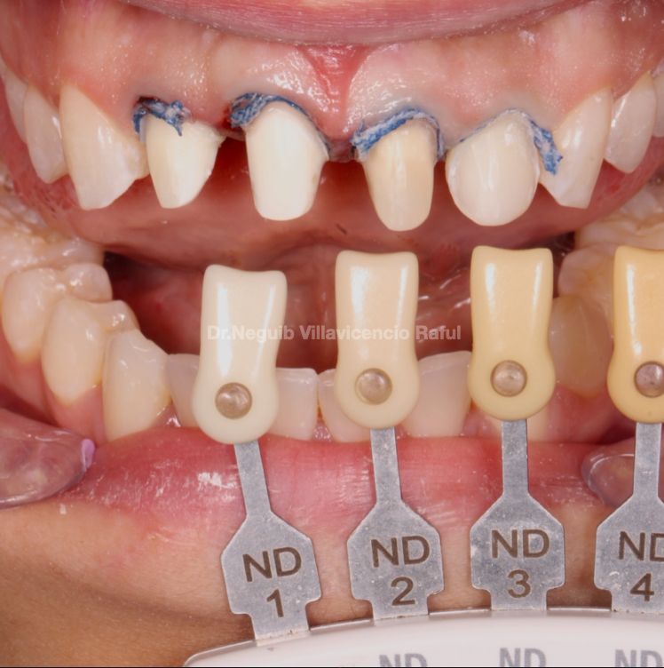 Neguib Villavicencio Raful-40