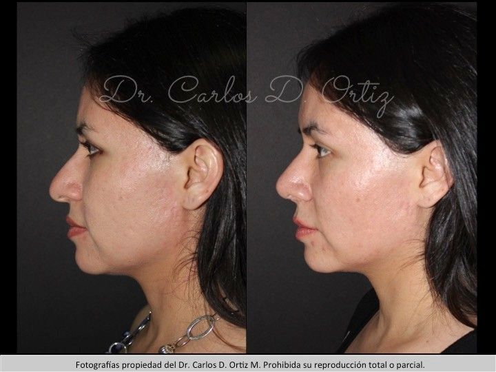 Carlos David Ortiz Moreno-26