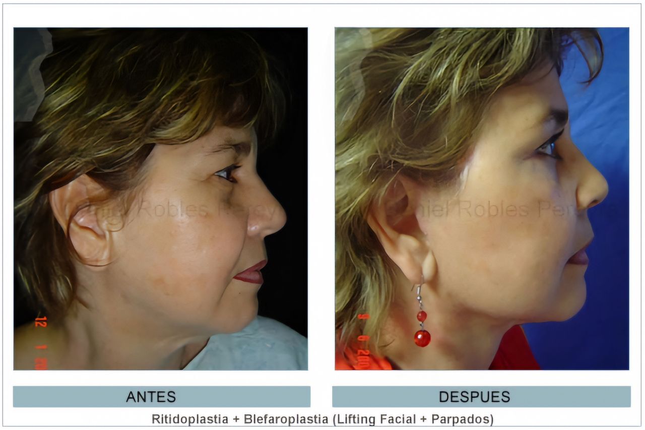 Daniel Robles Pereyra-2