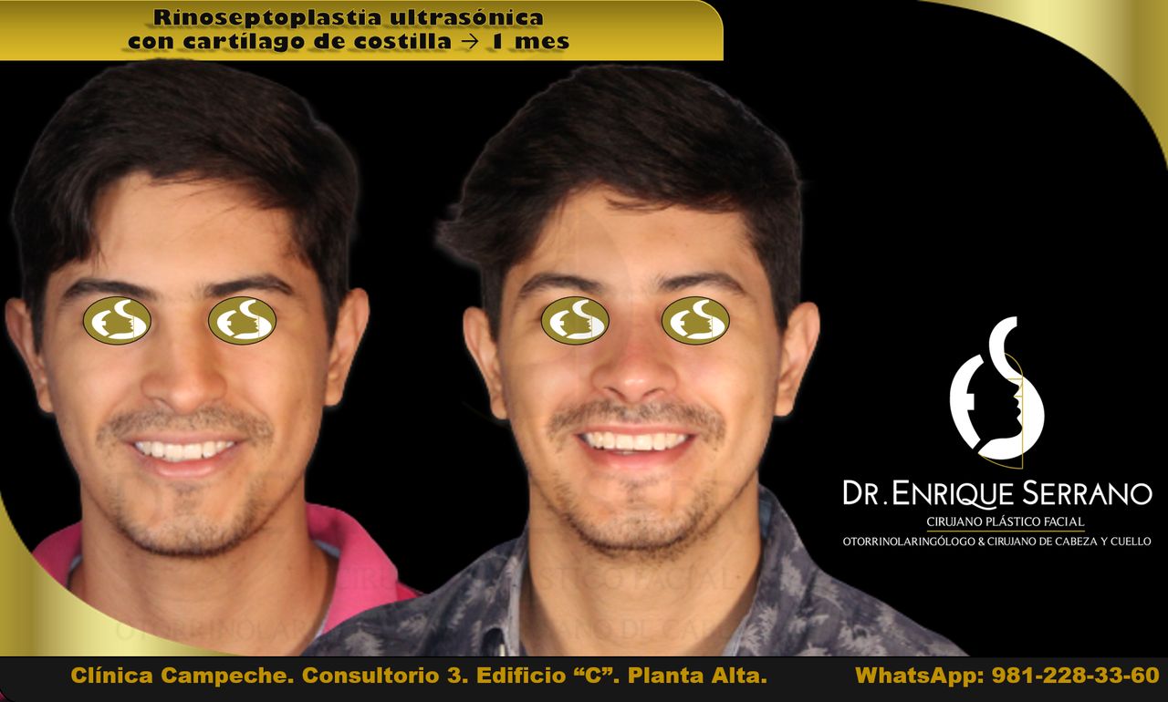 Enrique Serrano Cruz-17