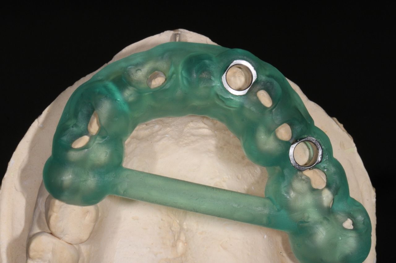 Luis Alonso Flores Reyna-13