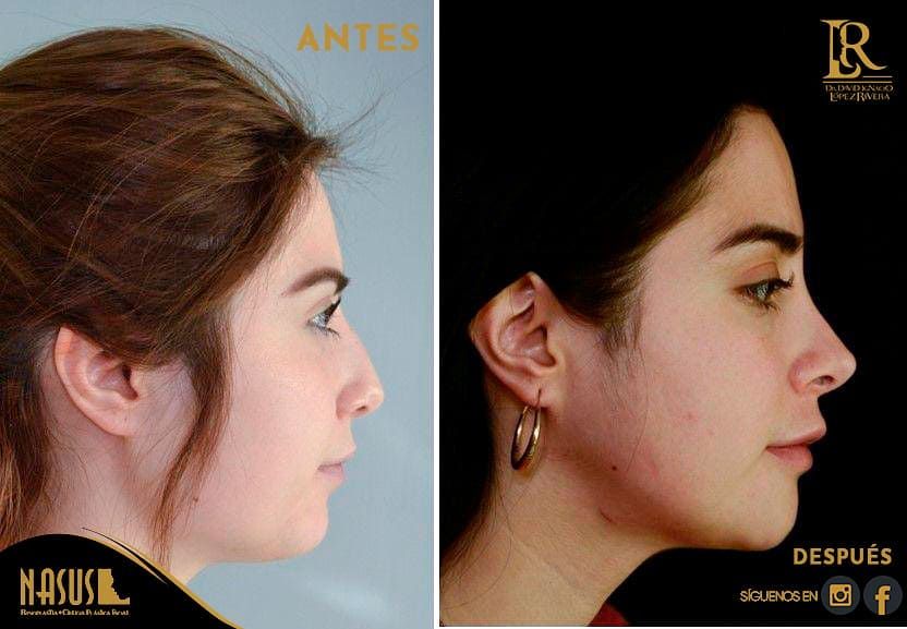 David Ignacio López Rivera-11