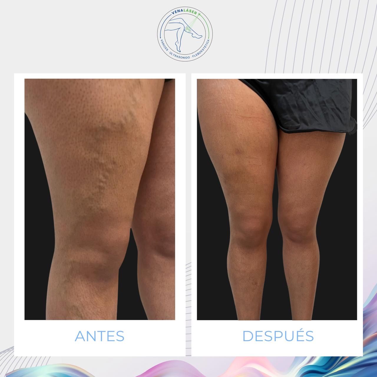 Mishell Eduardo Santander Becerra-10