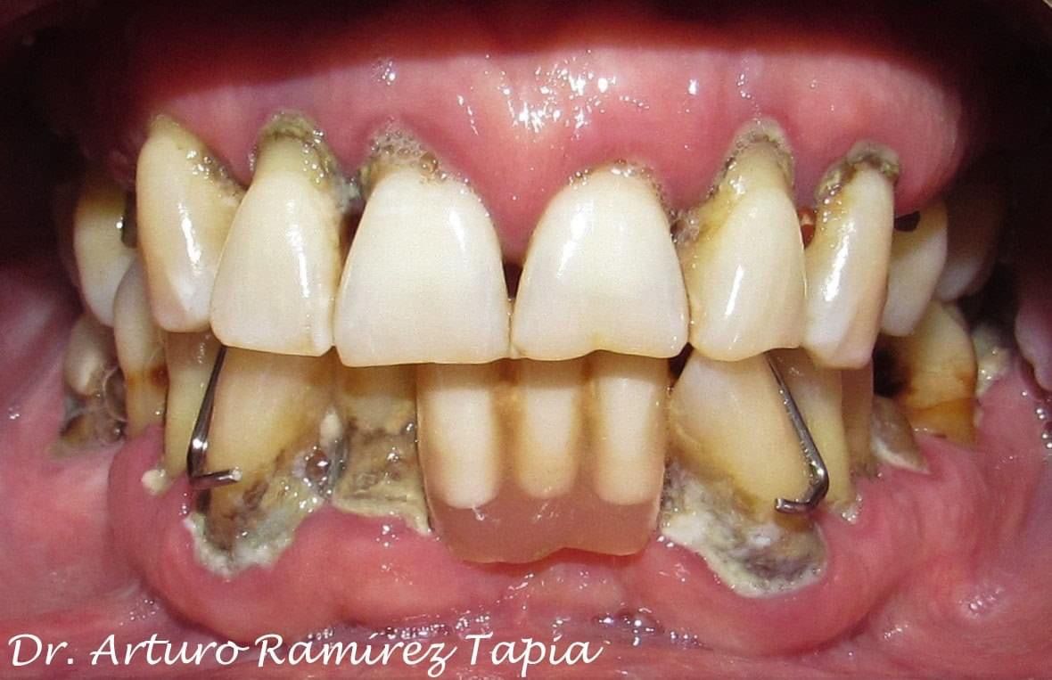 Arturo Ramírez Tapia-13