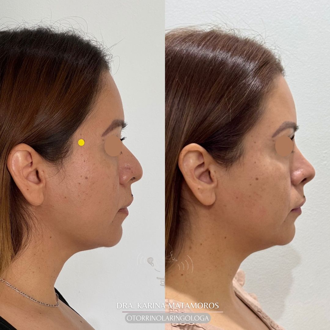 Ana Karina Matamoros Conejo-7