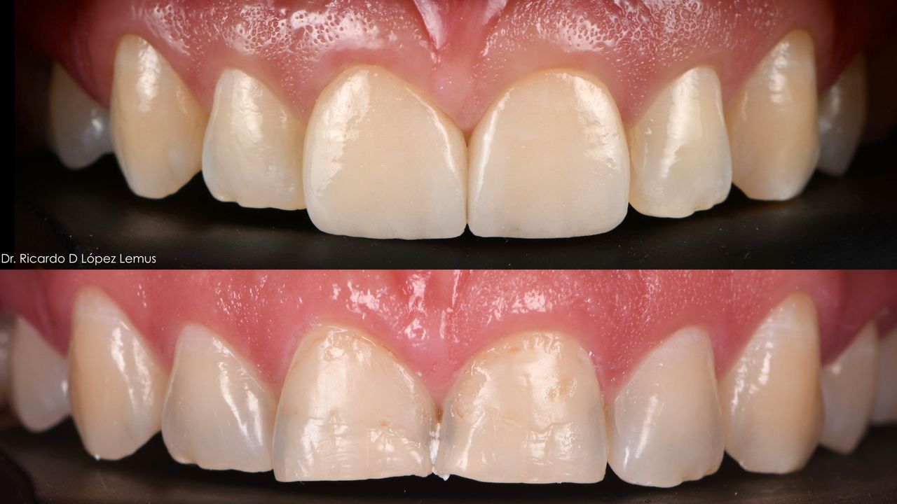 Ricardo López Lemus-76