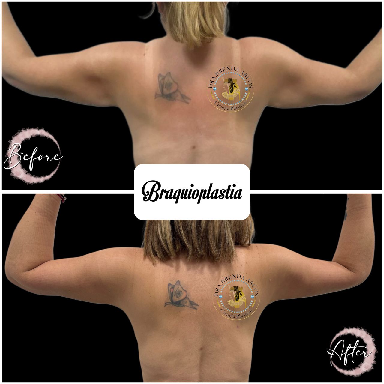 Brenda Arcos Vera-35