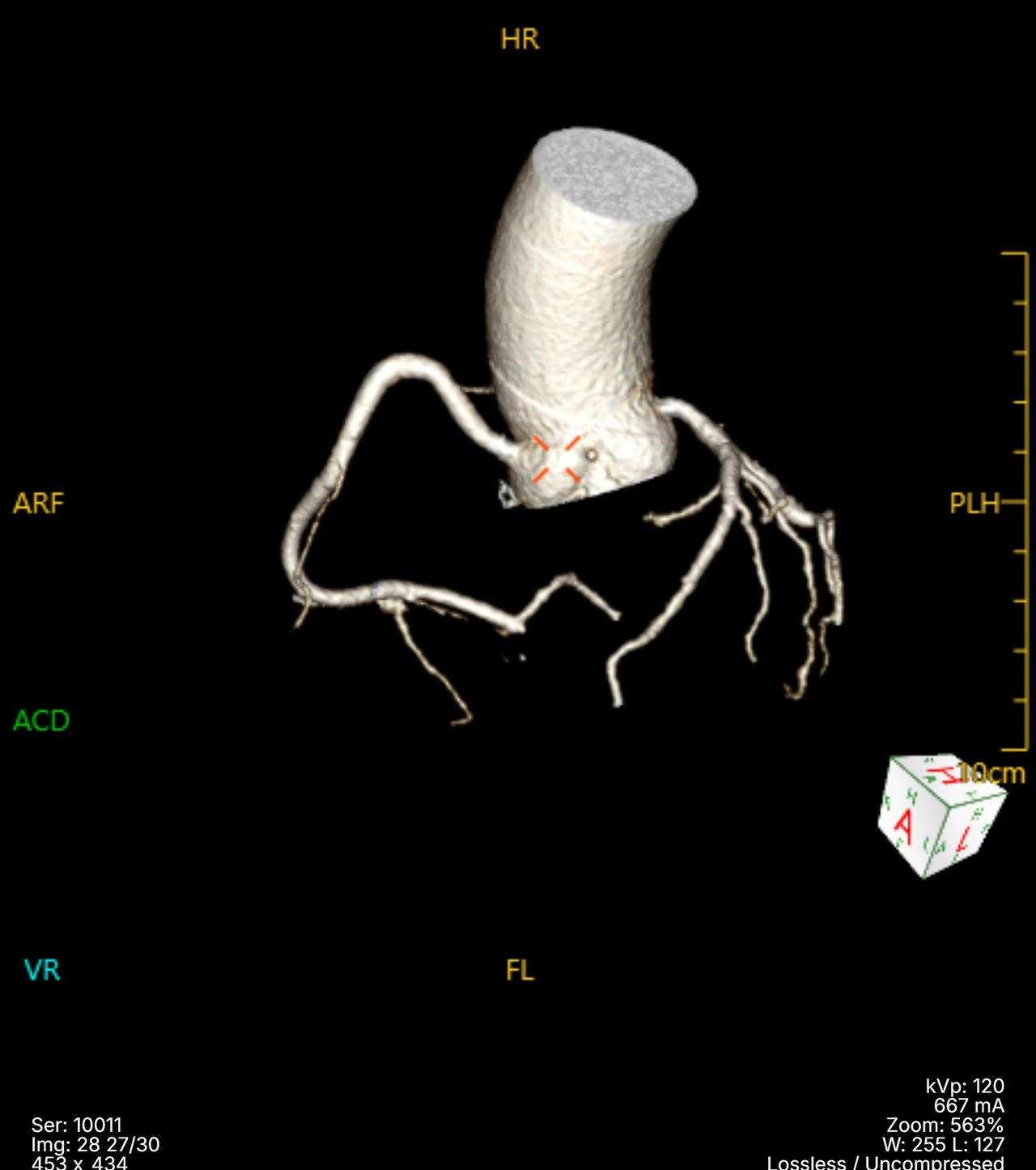 Iván A. Barreto Alanis-2