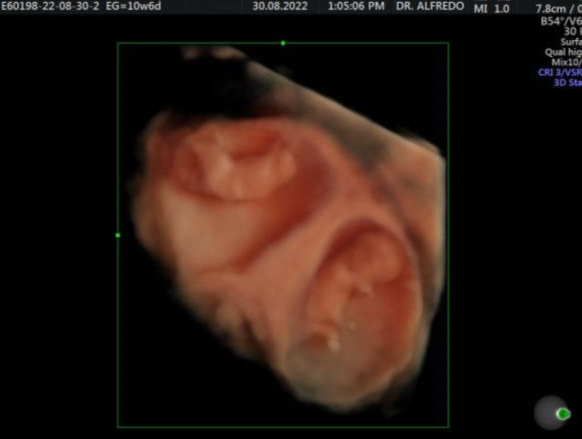 Alfredo Ramírez Cárdenas-1