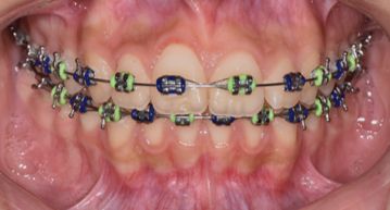 María Rossana Robles Sánchez-9