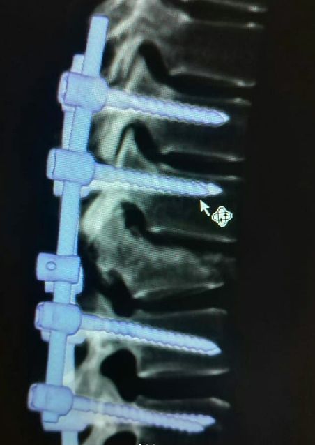 Francisco Prado Mercado-6