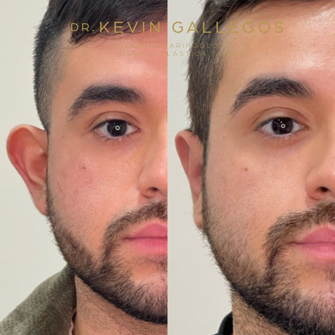 Kevin Iram Gallegos Montero-5