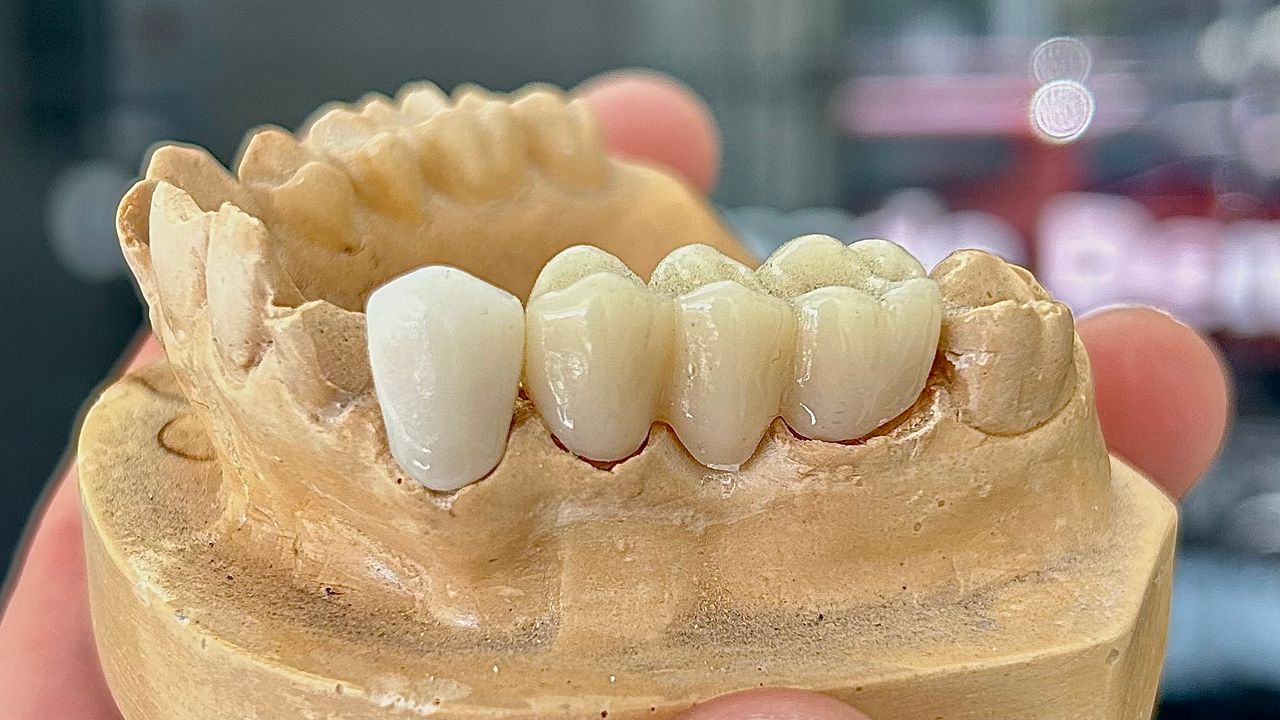 Solyenitzin Herrera Miron-9