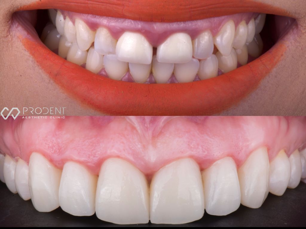 Ulises Pérez Murillo-51