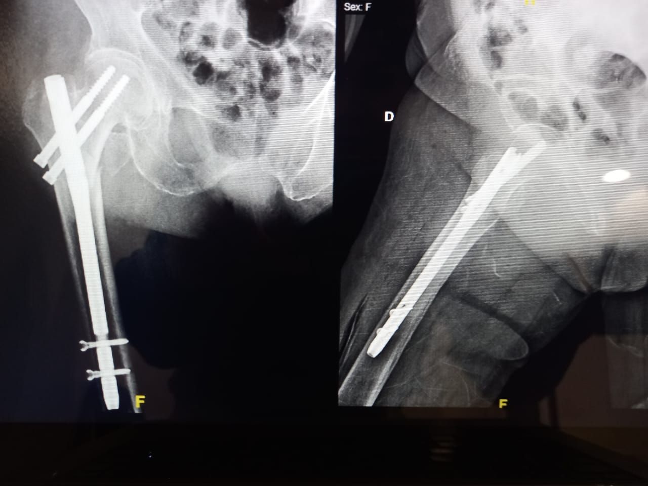 Mayra Deni Peredo Aburto-3