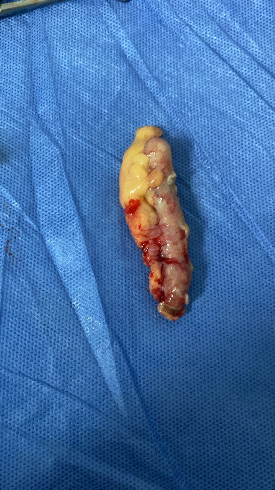 Alejandro Bailón Calderón-1