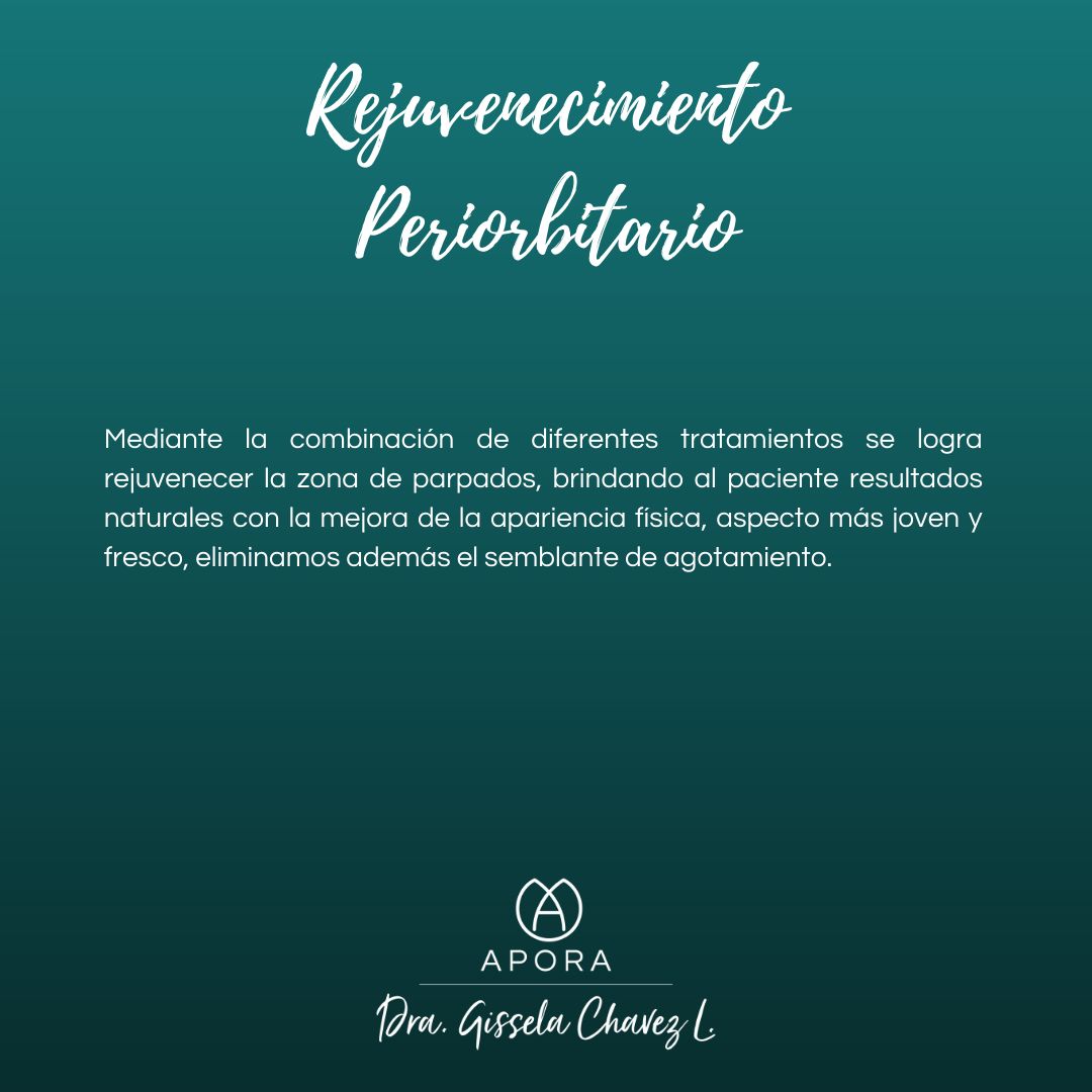 Gissela Chávez Lizardi-22