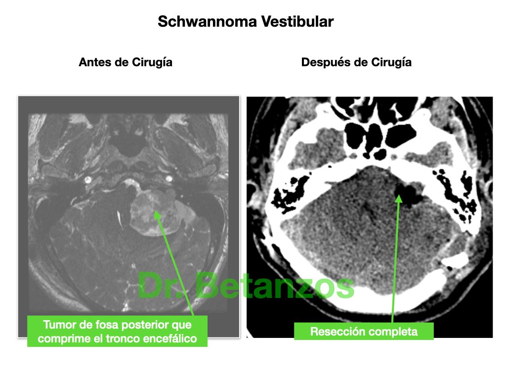 Aleixandre Betanzos Villegas-14