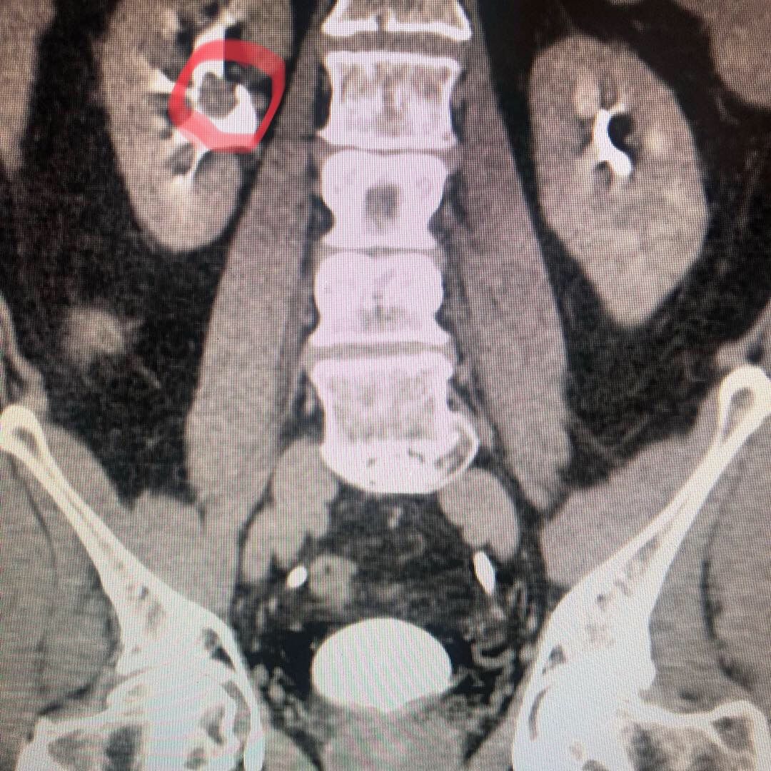 Mauricio Cantellano Orozco-14