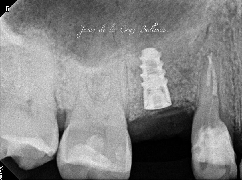 Jesus De La Cruz Ballinas-20