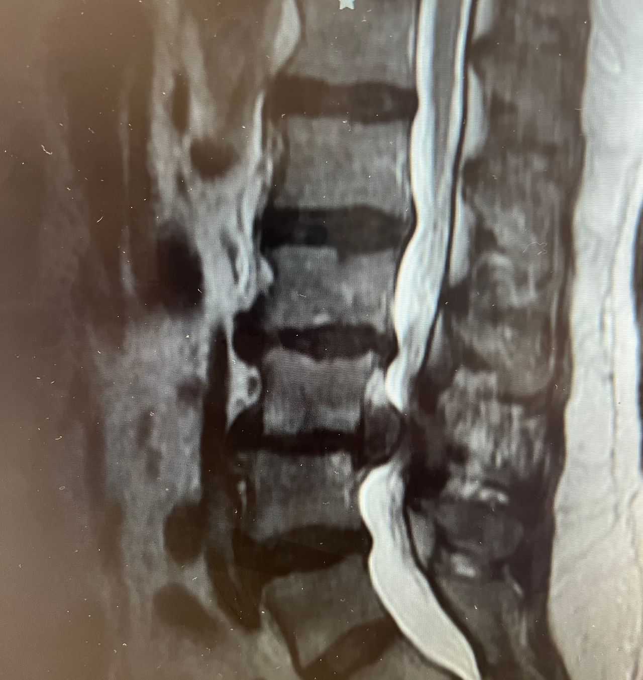 Juan Lopez Valencia-0